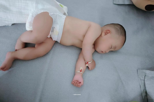 福安六个月宝宝眼睛散光